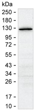 SMC2 (acetyl K114)